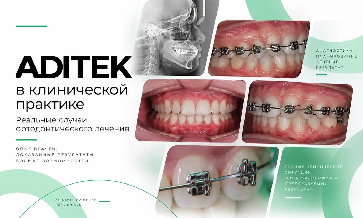 ADITEK в клинической практике: подборка случаев